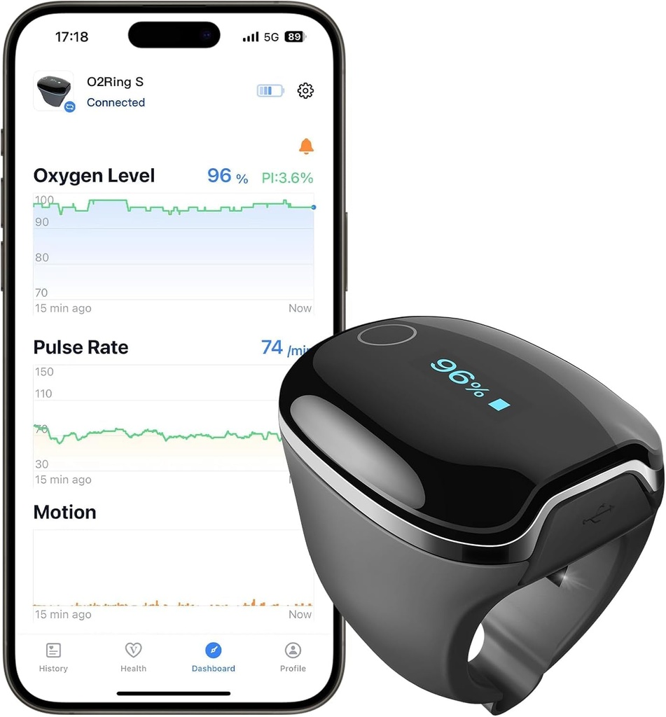 Wellue O2Ring-S Sleep Pulse Oximeter Bluetooth with Vibration Reminder, 24 Hour Battery Lif