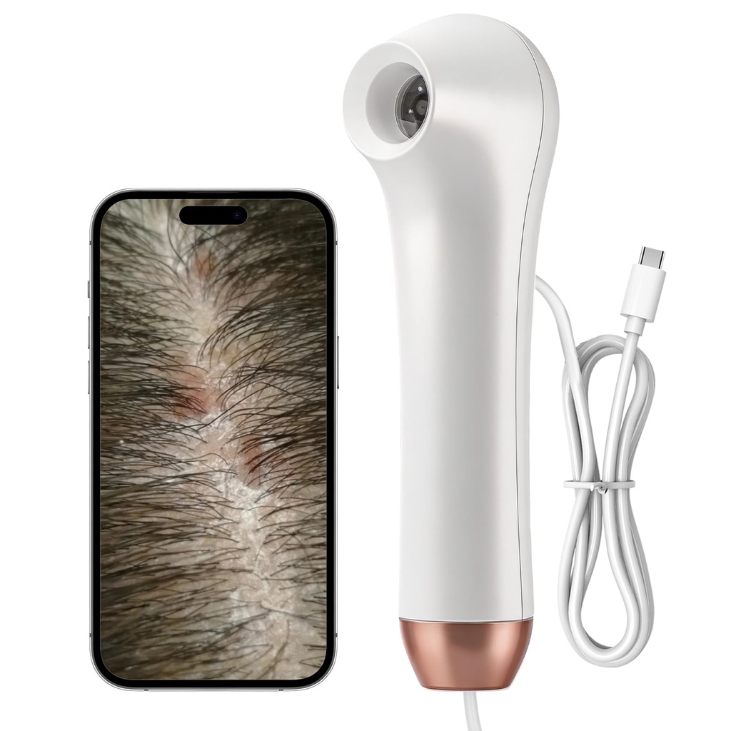 Portable Scalp Analysis Machine, 3 Gears Skin Hair Analyzer, 1 Megapixel Scalp Microscope